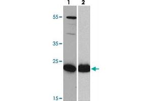 Western blot analysis of HIV-1 p24 with HIV-1 p24 monoclonal antibody  at (lane 1) 0. (HIV-1 p24 antibody)