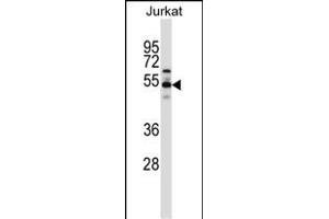 VPS4B Antibody (C-term) (ABIN657734 and ABIN2846719) western blot analysis in Jurkat cell line lysates (35 μg/lane). (VPS4B antibody  (C-Term))
