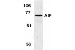 Western blot analysis of AIF in K562 cell lysate with AP30029PU-N AIF antibody at 1 μg/ml. (AIF antibody  (N-Term))