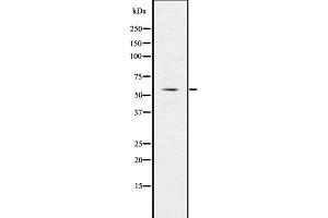 Western blot analysis of IRG1 using LOVO whole  lysates. (IRG1 antibody  (C-Term))