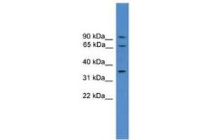 Image no. 1 for anti-Calicin (CCIN) (AA 151-200) antibody (ABIN6745324) (Calicin antibody  (AA 151-200))