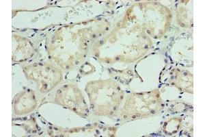 Immunohistochemistry of paraffin-embedded human kidney tissue using ABIN7144972 at dilution of 1:100 (DHX9 antibody  (AA 325-840))