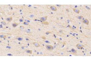 Detection of MAP2 in Human Cerebrum Tissue using Polyclonal Antibody to Microtubule Associated Protein 2 (MAP2) (MAP2 antibody  (AA 727-985))