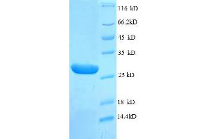 SDS-PAGE (SDS) image for Integrin-Linked Kinase (ILK) (AA 1-228), (partial) protein (His tag) (ABIN5712103)