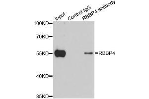 Immunoprecipitation analysis of 200 μg extracts of 293T cells using 1 μg RBBP4 antibody (ABIN5970697). (Retinoblastoma Binding Protein 4 antibody)