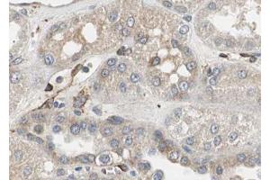 ABIN6267034 at 1/100 staining human Kidney tissue sections by IHC-P.