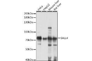 Western blot analysis of extracts of various cell lines, using S antibody (ABIN7270138) at 1:1000 dilution. (SALL4 antibody  (AA 853-1053))