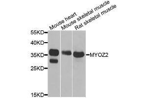 Western blot analysis of extracts of various cell lines, using MYOZ2 antibody. (MYOZ2 antibody)