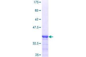 DDX4 Protein (AA 625-724) (GST tag)