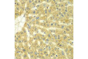 Immunohistochemistry of paraffin-embedded rat liver using ADCK3 antibody at dilution of 1:100 (x40 lens).