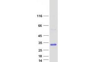Validation with Western Blot (RAB33A Protein (Myc-DYKDDDDK Tag))