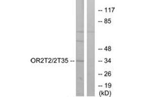 Western blot analysis of extracts from HepG2 cells, using OR2T2/2T35 Antibody. (OR2T2/2T35 antibody  (AA 61-110))
