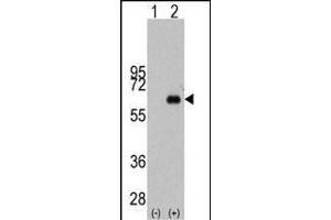 Western blot analysis of MYC (arrow) using rabbit polyclonal MYC Antibody (S62) (ABIN388721 and ABIN2838830). (c-MYC antibody  (AA 40-69))