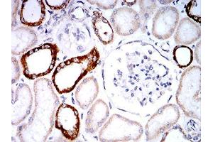 Immunohistochemical analysis of paraffin-embedded renal tissues using PLD2 mouse mAb with DAB staining.