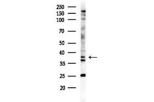 anti-Solute Carrier Family 10 (Sodium/bile Acid Cotransporter Family), Member 2 (SLC10A2) (C-Term) antibody