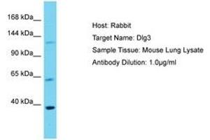 Image no. 1 for anti-Discs, Large Homolog 3 (DLG3) (AA 201-250) antibody (ABIN6750501) (DLG3 antibody  (AA 201-250))