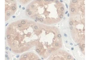 Detection of GREM1 in Human Kidney Tissue using Monoclonal Antibody to Gremlin 1 (GREM1) (GREM1 antibody  (AA 26-184))