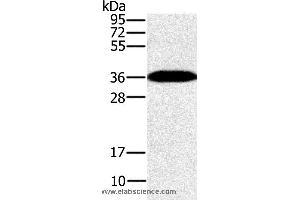 Western blot analysis of Mouse brain tissue, using PPP1CC Polyclonal Antibody at dilution of 1:200 (PPP1CC antibody)