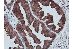 Immunohistochemical staining of paraffin-embedded Human breast tissue using anti-C20orf3 mouse monoclonal antibody. (APMAP antibody)