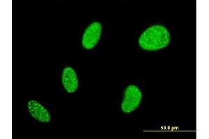 Immunofluorescence of monoclonal antibody to BCL7B on HeLa cell. (BCL7B antibody  (AA 124-202))