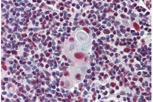 Immunohistochemistry (Formalin-fixed Paraffin-embedded Sections) (IHC (fp)) image for anti-Histone Deacetylase 1 (HDAC1) (AA 271-477) antibody (ABIN574014)