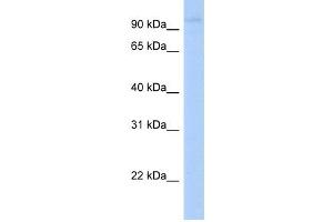 LRRC8A antibody used at 1 ug/ml to detect target protein. (LRRC8A antibody  (N-Term))