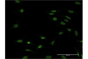 Immunofluorescence of monoclonal antibody to FOXL1 on HeLa cell. (FOXL1 antibody  (AA 132-240))