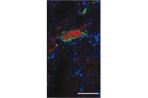 Immunofluorescence image of Substance P staining in vibratome section of rat spinal cord. (Substance P antibody)