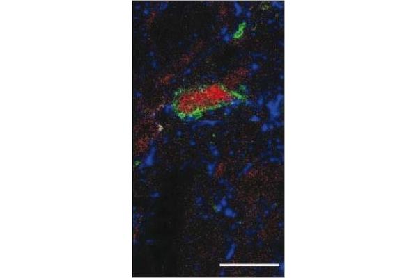 Substance P antibody