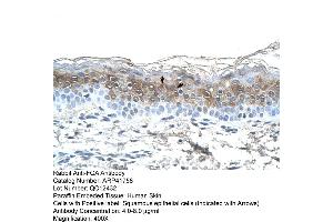 Rabbit Anti-FGA Antibody  Paraffin Embedded Tissue: Human Skin Cellular Data: Squamous epithelial cells Antibody Concentration: 4. (FGA antibody  (N-Term))