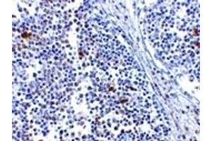 Immunohistochemistry (IHC) image for anti-Interferon Induced with Helicase C Domain 1 (IFIH1) (Middle Region) antibody (ABIN1031000) (IFIH1 antibody  (Middle Region))