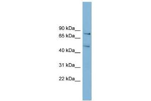 BOP1 antibody used at 1 ug/ml to detect target protein.
