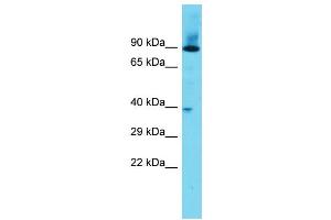 Host: Rabbit Target Name: DPY19L3 Sample Type: Fetal Heart lysates Antibody Dilution: 1. (DPY19L3 antibody  (N-Term))