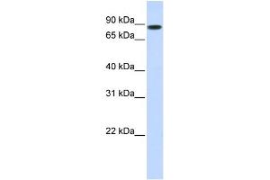 WB Suggested Anti-STAT5B Antibody Titration: 1 ug/ml Positive Control: 293T cells lysate There is BioGPS gene expression data showing that STAT5B is expressed in HEK293T (STAT5B antibody  (N-Term))