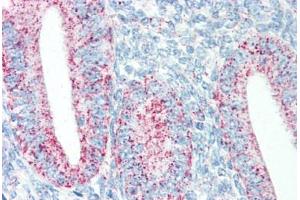 Human Uterus (formalin-fixed, paraffin-embedded) stained with HSPD1 antibody ABIN334251 at 5 ug/ml followed by biotinylated anti-mouse IgG secondary antibody ABIN481714, alkaline phosphatase-streptavidin and chromogen. (HSPD1 antibody)