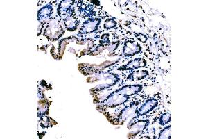 IHC analysis of KLF4 using anti-KLF4 antibody (ABIN7599343).