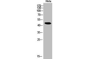 Western Blot analysis of Hela cells using Acetyl-NFκB-p65 (K314/K315) Polyclonal Antibody