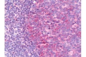 Anti-IMPDH1 antibody IHC staining of human tonsil. (IMPDH1 antibody  (AA 84-113))