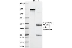 SDS-PAGE Analysis Purified CD22 Mouse Monoclonal Antibody (FR10B4). (CD22 antibody)