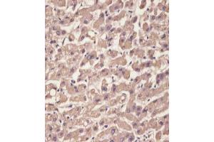(ABIN652227 and ABIN2840949) staining TTR in human liver tissue sections by Immunohistochemistry (IHC-P - paraformaldehyde-fixed, paraffin-embedded sections). (TTR antibody  (C-Term))