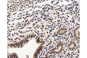 Immunohistochemistry analysis of paraffin-embedded mouse uters using MGMT Polyclonal Antibody at dilution of 1:300. (MGMT antibody)