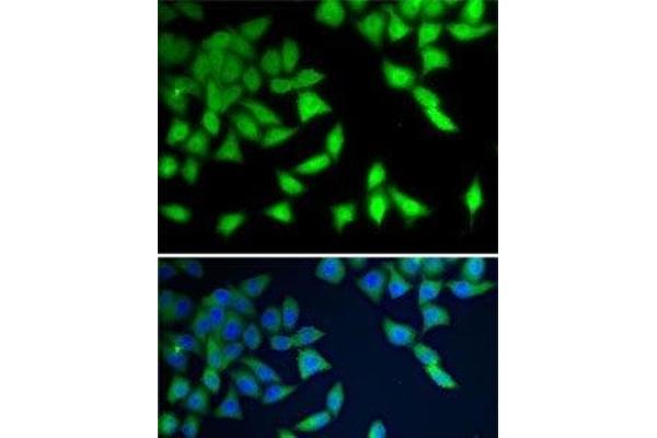 WDR77 antibody