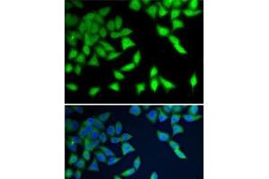 Immunofluorescence analysis of A-549 cells using WDR77 Polyclonal Antibody (WDR77 antibody)