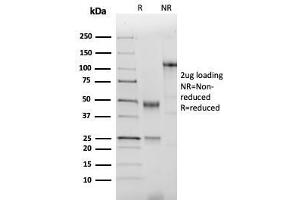 SDS-PAGE Analysis of Purified NKX2. (Nkx2-2 antibody  (AA 1-119))