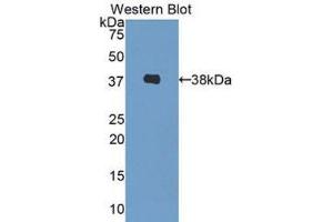 Western Blotting (WB) image for anti-Decorin (DCN) (AA 31-359) antibody (ABIN1175530) (Decorin antibody  (AA 31-359))