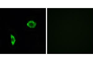 Immunofluorescence analysis of LOVO cells, using Prostacyclin Receptor antibody.