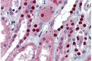Human Kidney: Formalin-Fixed, Paraffin-Embedded (FFPE) (MPDZ antibody  (AA 1691-1740))