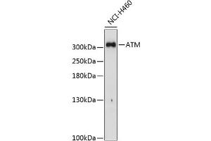 Western blot analysis of extracts of H460 cells, using ATM Antibody (ABIN6133566, ABIN6137281, ABIN6137282 and ABIN6221615) at 1:1000 dilution. (ATM antibody  (AA 1900-2000))