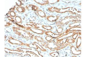 Formalin-fixed, paraffin-embedded human kidney stained with Aurora B Recombinant Mouse Monoclonal Antibody (rAURKB/1592). (Recombinant Aurora Kinase B antibody  (AA 89-251))
