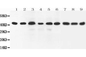 Western Blotting (WB) image for anti-SRY (Sex Determining Region Y)-Box 7 (SOX7) (AA 370-388), (C-Term) antibody (ABIN3042550)